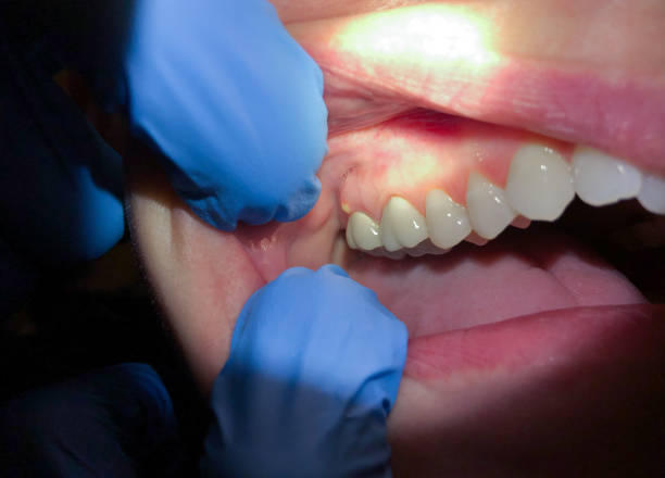 Best Urgent Tooth Repair  in Roland, OK