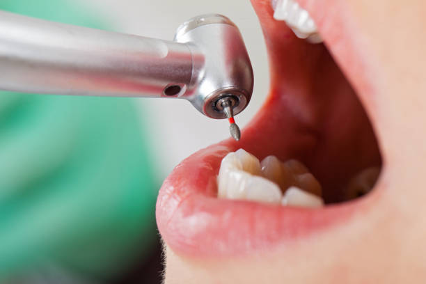 Best Urgent Tooth Repair  in Roland, OK